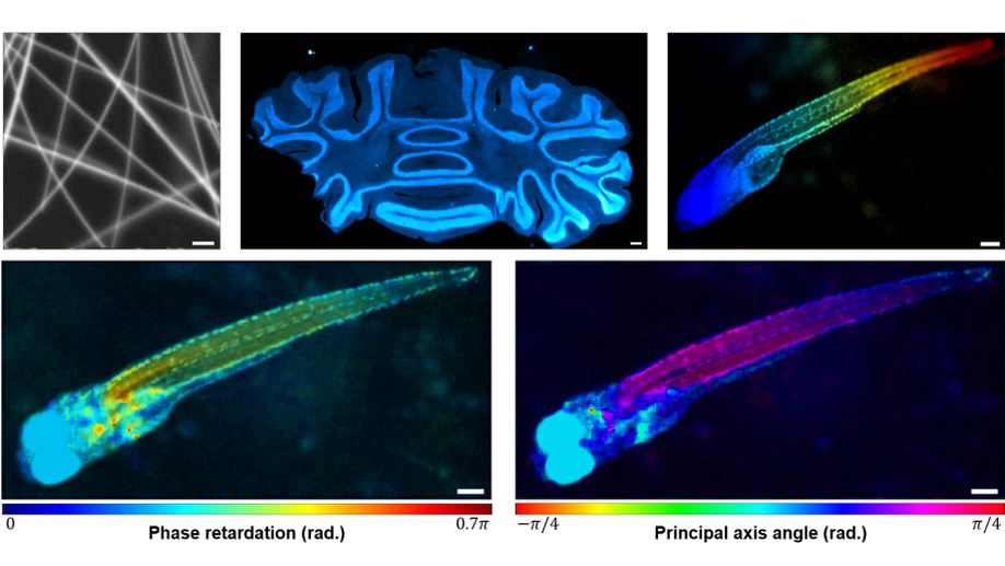 Quantum imaging of biological organisms through spatial and polarization entanglement